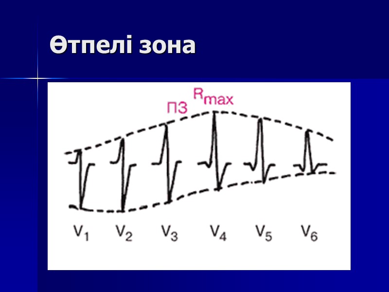 Өтпелі зона